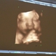 First Glance 3D/4D Ultrasound Studio