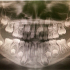 Boise Oral and Maxillofacial Surgery