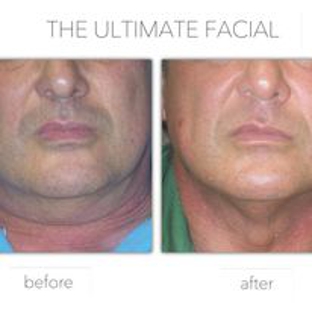 The Ultimate Facial - Santa Ana, CA