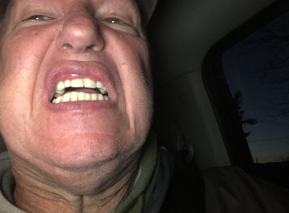 Larry Alan Bacon, DDS - Kingsport, TN. Misaligned teeth. Courtesy of your friendly, uncaring QUACK, dentist. L Alan Bacon!