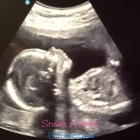 Sneak A Peek Ultrasound Jonesboro