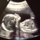 Sneak A Peek Ultrasound Jonesboro