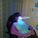 SmileLabs of Pleasanton Cosmetic Teeth Whitening - Teeth Whitening Products & Services