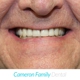 Cameron Family Dental