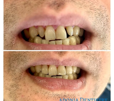 Adonia Dentistry Houston - Houston, TX