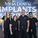 Mesa Dental Implants and Dentures - Implant Dentistry