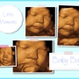 Cherished Memories Ultrasound