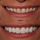 Dental Implant Solutions of Idaho - Implant Dentistry