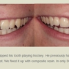 Facer Hales Parker Dentistry | Veneers - Implants - Comprehensive gallery