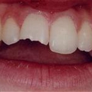 John W. Kuhl, DMD - Prosthodontists & Denture Centers
