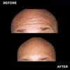 Mister Botox gallery