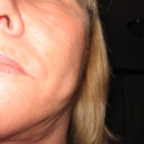 Greenville Plastic Surgery, P.A. - Physicians & Surgeons, Cosmetic Surgery