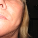 Greenville Plastic Surgery, P.A.