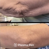 Limelight Laser and Medical Spa gallery