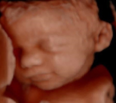 Hello Baby! 4D Ultrasound Studio - Fayetteville, AR