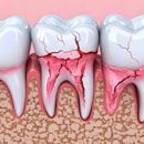 Dental Care Arlington Heights - Implant Dentistry