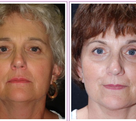 Zollman Plastic Surgery - Indianapolis, IN