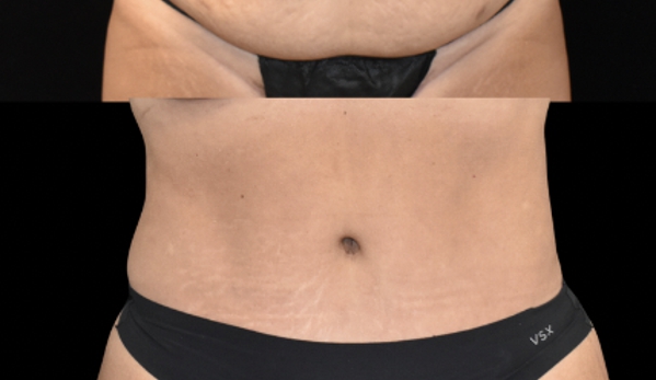 SynergyMD Plastic Surgery - Tampa, FL