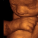 3D 4D Baby Breath Ultrasound Studio - Physicians & Surgeons, Obstetrics And Gynecology