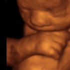 3D 4D Baby Breath Ultrasound Studio