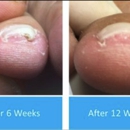 Advanced Foot & Ankle Specialists - Physicians & Surgeons, Podiatrists