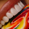 Charm Dental - Spring gallery