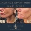 Black Lotus Wellness & Aesthetics gallery