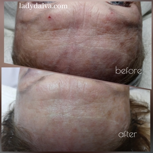 Lady Daiva Skin Care - Fort Myers, FL. Anti-Aging Treatment