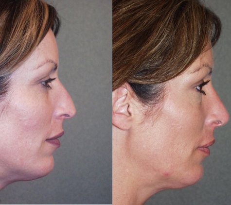 Changes Plastic Surgery & Spa - San Diego, CA