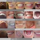 Leiker Orthodontics - Woodlands - Orthodontists