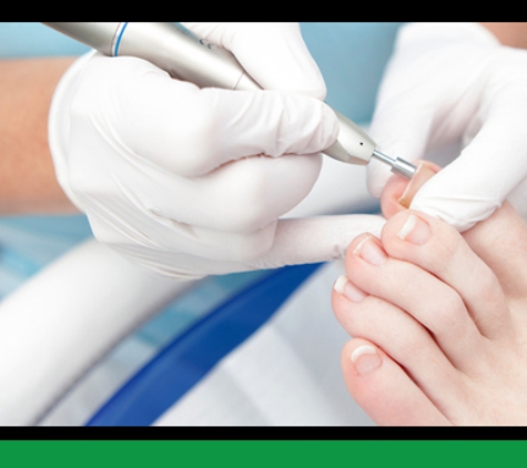 The Foot and Ankle Clinic - Traralgon, VIC. Fungal Nail Treatments