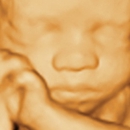 My Baby's First Photos - Medical Imaging Services