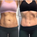 Wymore Laser & Anti-Aging Medicine in Winter Park, FL - Day Spas
