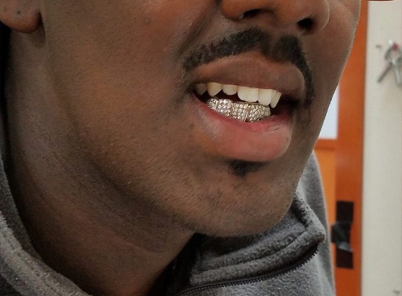 Custom Gold Grills - Seattle, WA