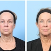 Dr. Drew Davis, MD – Plastic Surgery gallery