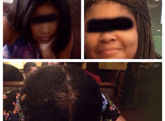 Flo African Hair Braiding - Albany, NY. My daughter’s hair blown out by regular stylist, then braided by Flo’s����, and the resulting bald spot after. Never again. Just don’t do it.