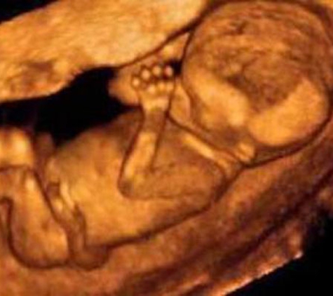 Fetal Memories 2D 3D 4D Ultrasound - Orange, CA