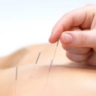 Be Well Acupuncture