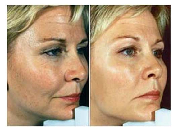 Skin Sensations - Allambie Heights, NSW