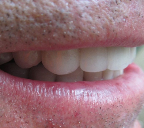 All-In-One Dental Montrose - Dr. Daniel Hatch - Montrose, CO
