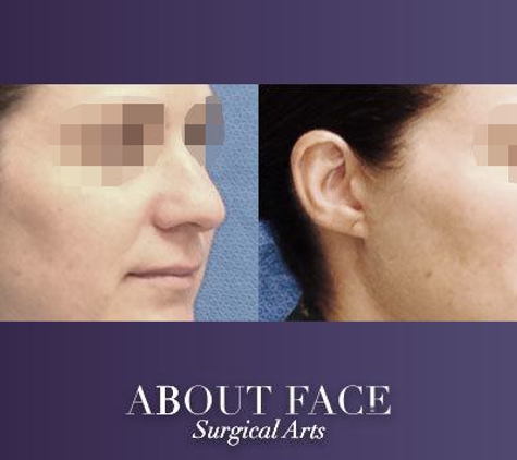 About Face Surgical Arts: Khurram A. Khan BDS, DMD - Cincinnati, OH