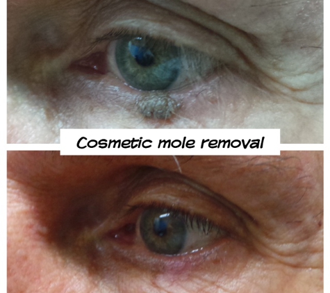 Cosmetic Laser & Skin Cancer Centre - Brendale, QLD