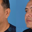 Bader Facial Plastics - Physicians & Surgeons, Pediatrics-Plastic & Reconstructive Surgery