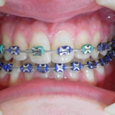Santelli Orthodontics - Orthodontists