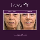 LazerLift Orlando - Physicians & Surgeons, Plastic & Reconstructive