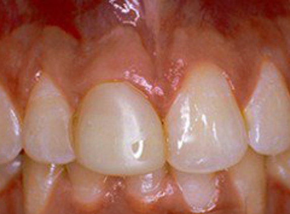 Applebite Dental Care - Norman, OK