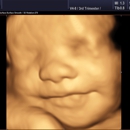 Heavenly 3D 4D Ultrasounds - Medical Imaging Services