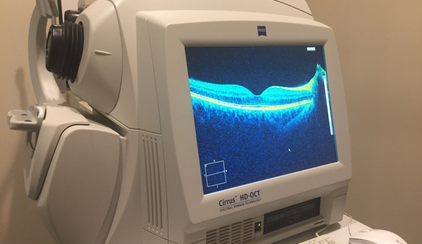 Alpert Vision Care - Woodland Hills, CA. Advanced Retinal Scanner