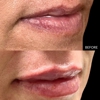 Beyond Esthetics Medspa gallery