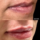 Beyond Esthetics Medspa - Hair Removal